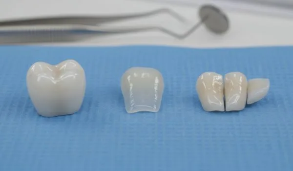 Couronne, facette et inlay-onlay en céramique posés sur un plateau dentaire